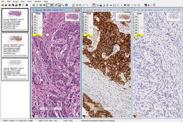 Aperio ImageScope 分析系统